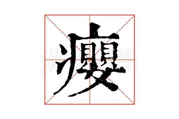 癭